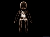 xray-27.jpg